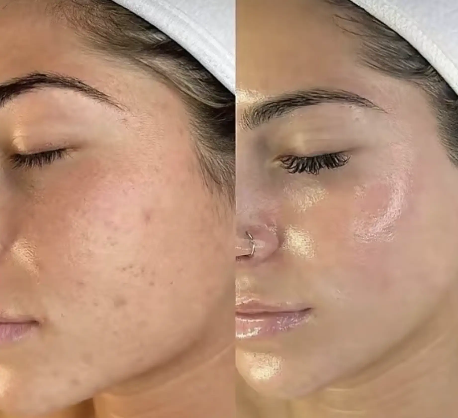 Your Skin Type Affects the Timing Too