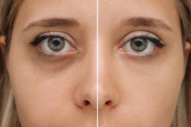 Comparison of woman's eyes before and after makeup application