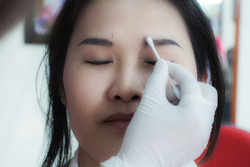 Saline-based eyebrow tattoo removal procedure